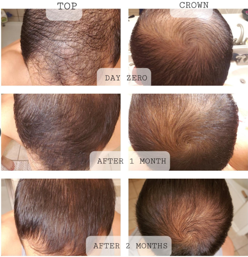 Amazing Result!