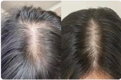 Risk-Free Results Guarantee